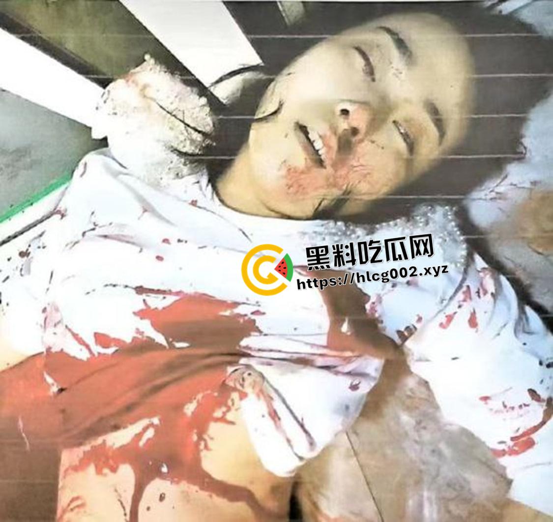 恐怖慎入！辽宁【徐园】案尸检现场视频流出 被前男友家暴致死打的面目全非-10