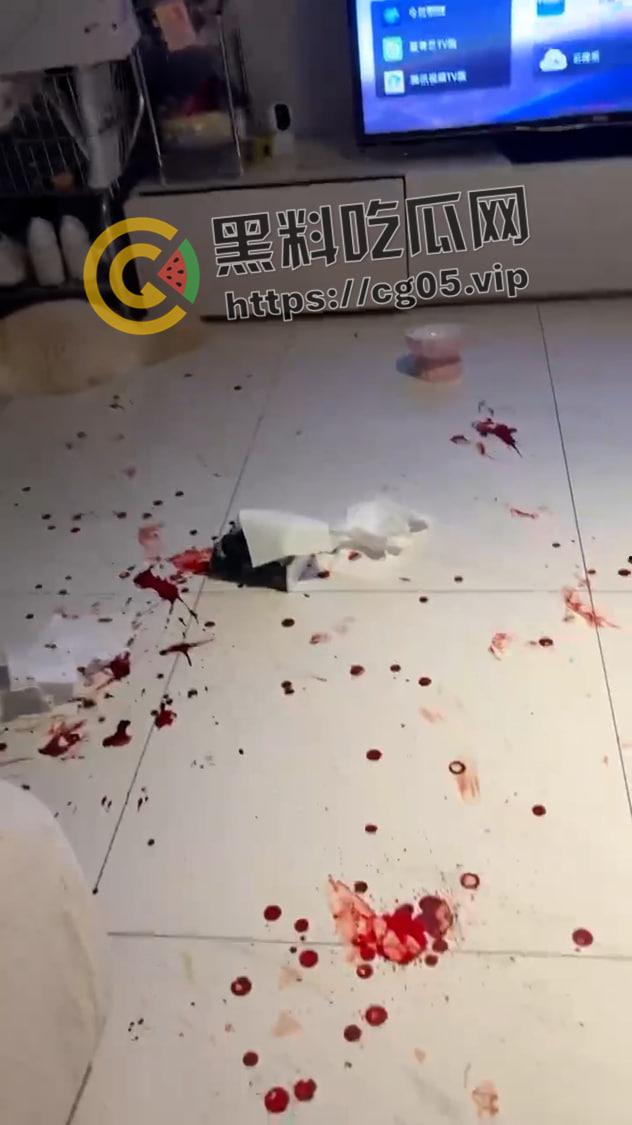 上海鸭王【闫啸天】和鸡婆的狗血爱情故事！鸭王性病 偷吃打鸡婆打到流产 属于是烂人比烂 家暴现场血腥画面流出-12