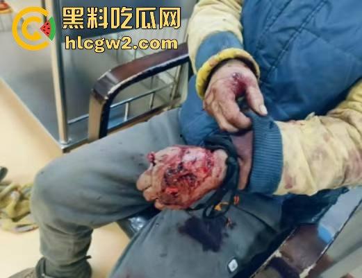 黑龙江勃利县长太村惊现野生东北虎入村 咬伤65岁大爷 大爷吃瓜看虎差点被虎吃 大爷还是大爷！-8