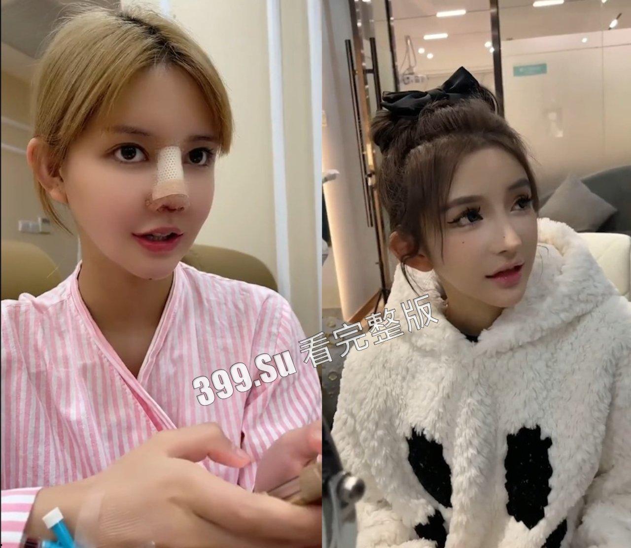 医美整形那些事儿  假的真不了  瓜友们能在生活中分辨出人造人吗？-2