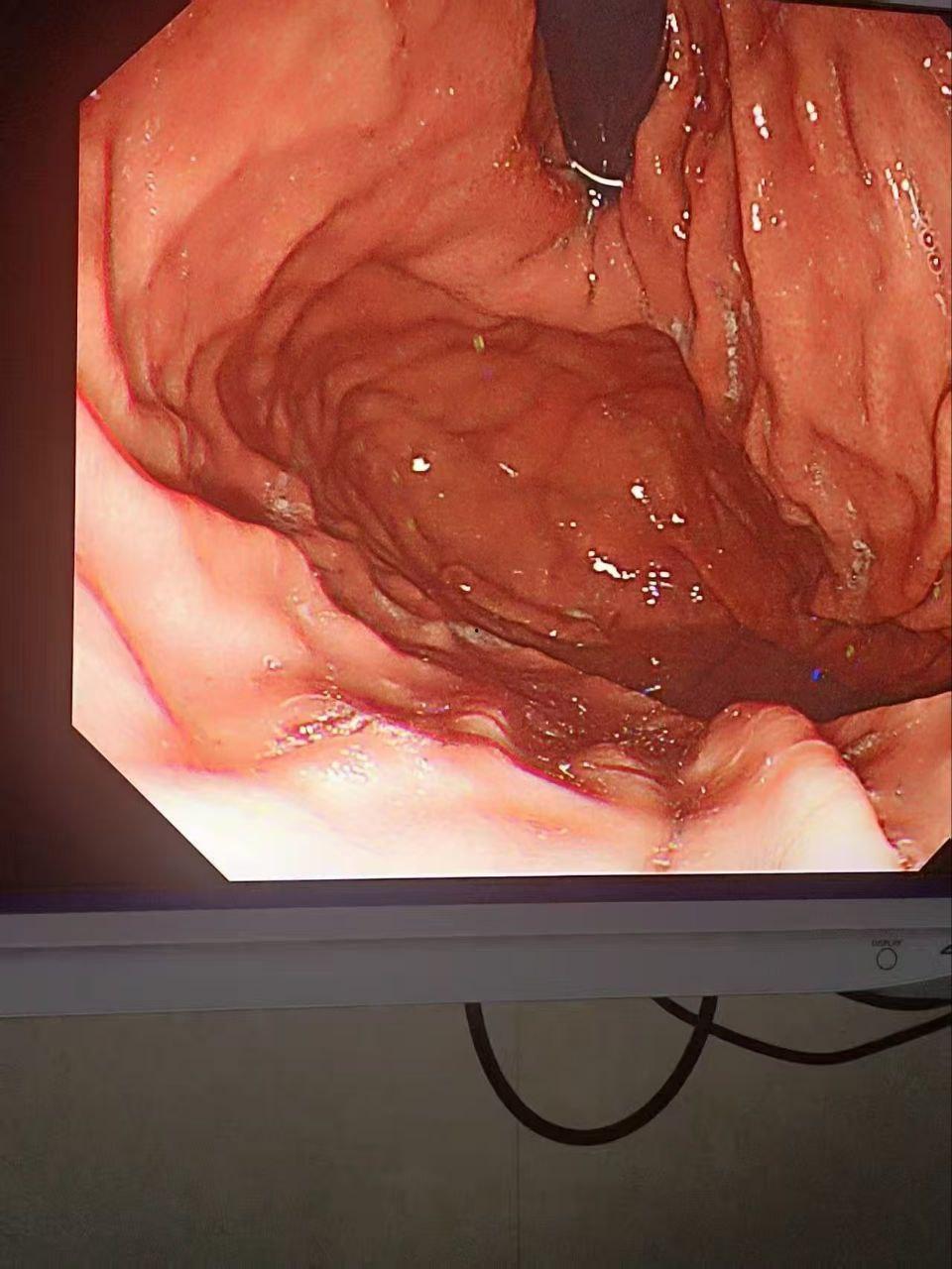 金主酒吧消费巨款，陪酒女为博金主一笑，酒后拳交，玩大了，金主爸爸手上戒指卡里面！-7