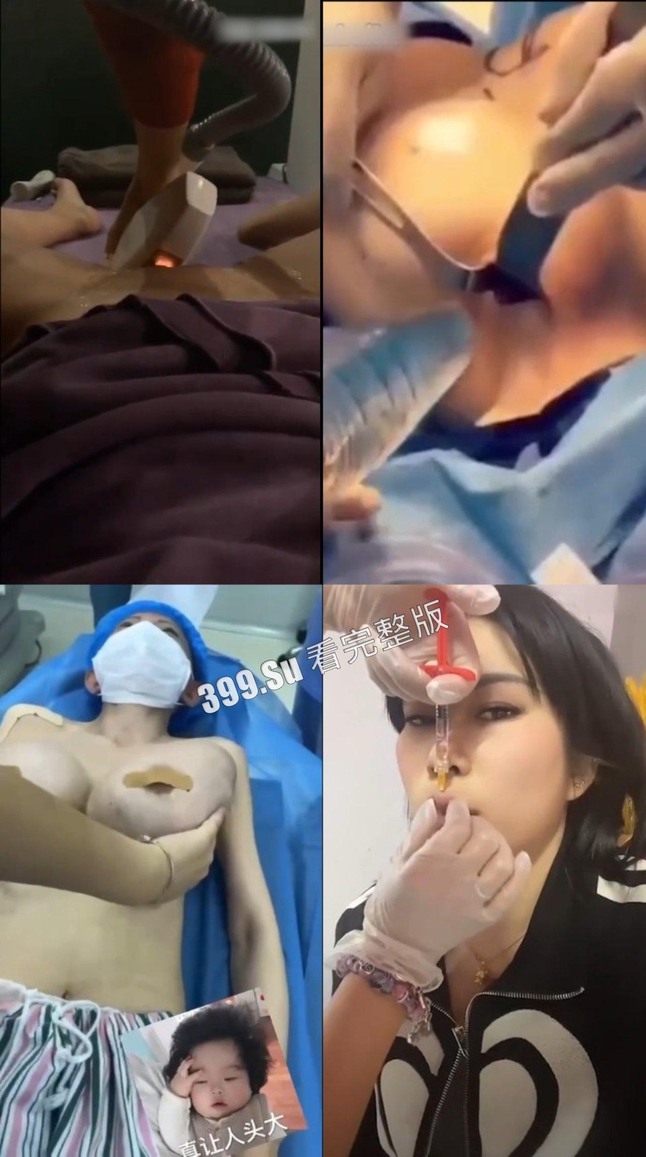 医美整形那些事儿  假的真不了  瓜友们能在生活中分辨出人造人吗？-9