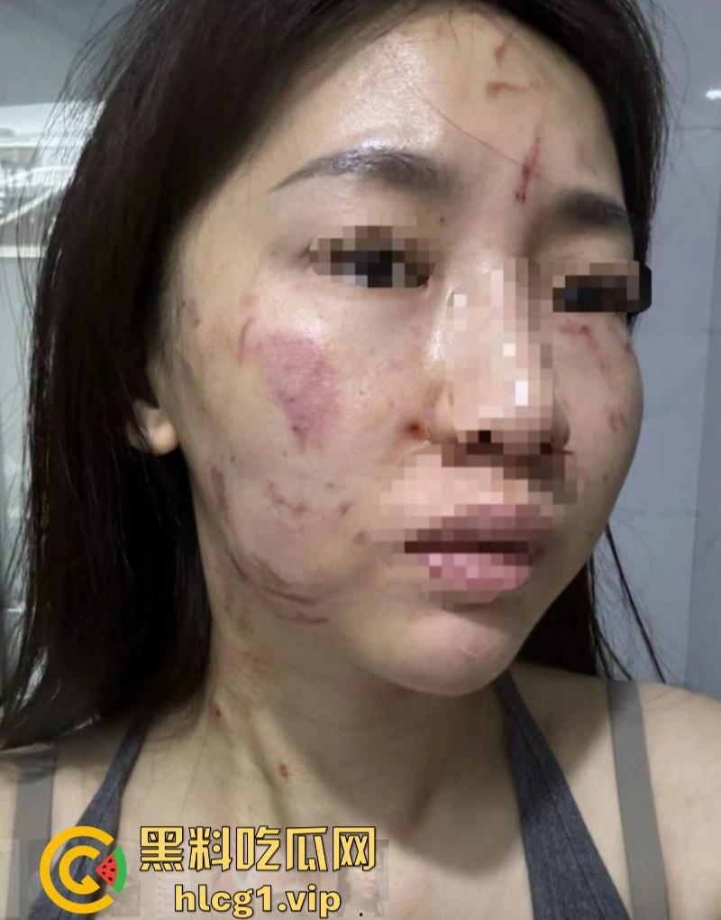 揭东区庵后村家暴男【高浩南】 不仅喜欢出轨还不怕报警 专吃硬的不愧是浩南哥！-8