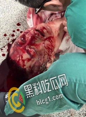 温州医科大学附属第一医院的一名医生被前来报复的患者家属认错人而被砍伤 随后砍人者负罪跳楼自杀-9