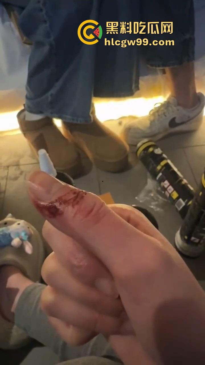 伦敦留学生与卖家交易气球因迟到大战，气球买卖差点变搏击赛，现场手指流血画面曝光！-9