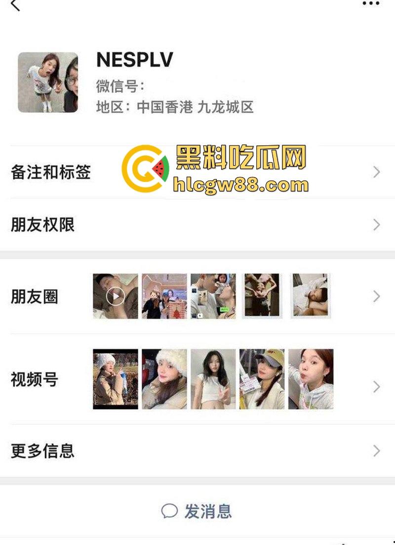 抖音厦门母狗【黄淮北】到处约炮聊骚居家狂热自慰 出去约炮时胸口的挂坠被实锤本人无疑！-2
