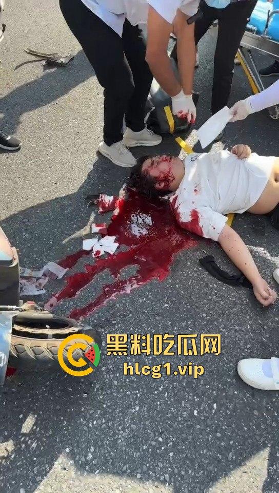 外卖小哥摩托车撞倒女子，女子头破血流浑身抽搐！-2