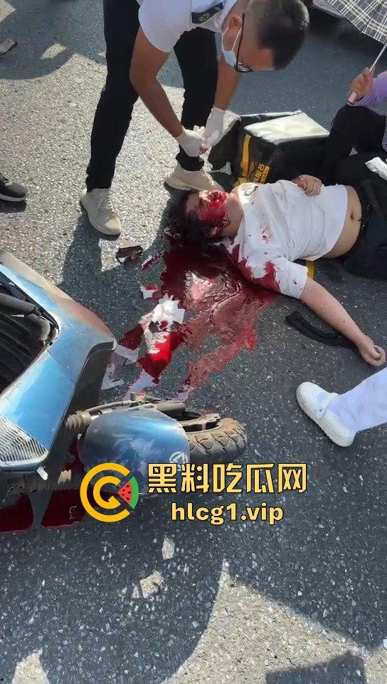 外卖小哥摩托车撞倒女子，女子头破血流浑身抽搐！-8