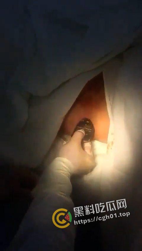 逆天！肛门掏出遥控器 这一定是不小心进去的吧  现场视频流出-3