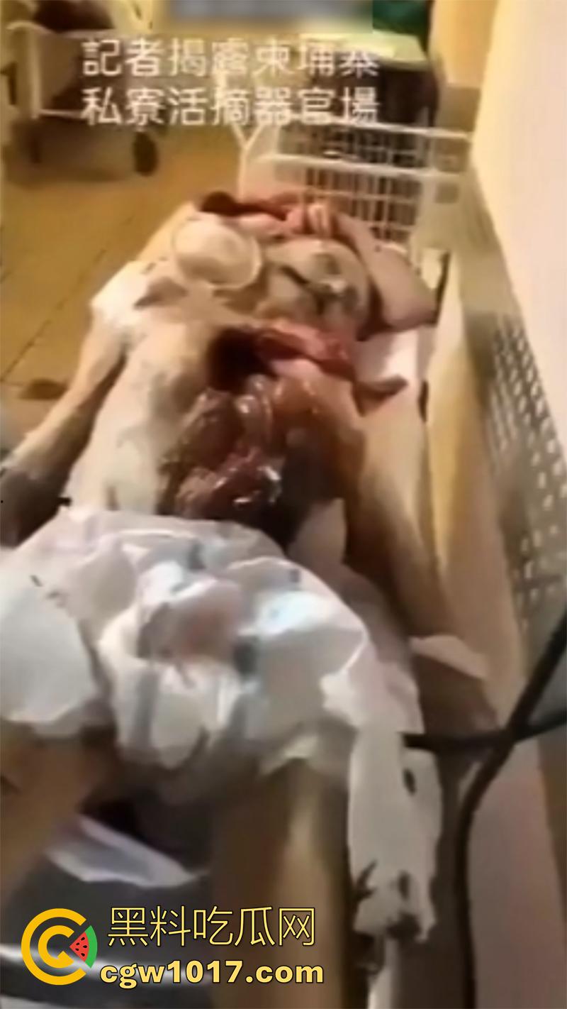 柬埔寨器官交易场实拍，猪仔狗推的最终贩卖地，难怪这里每个人都值钱，只要血型匹配有买主，立刻就会被拉走！-2
