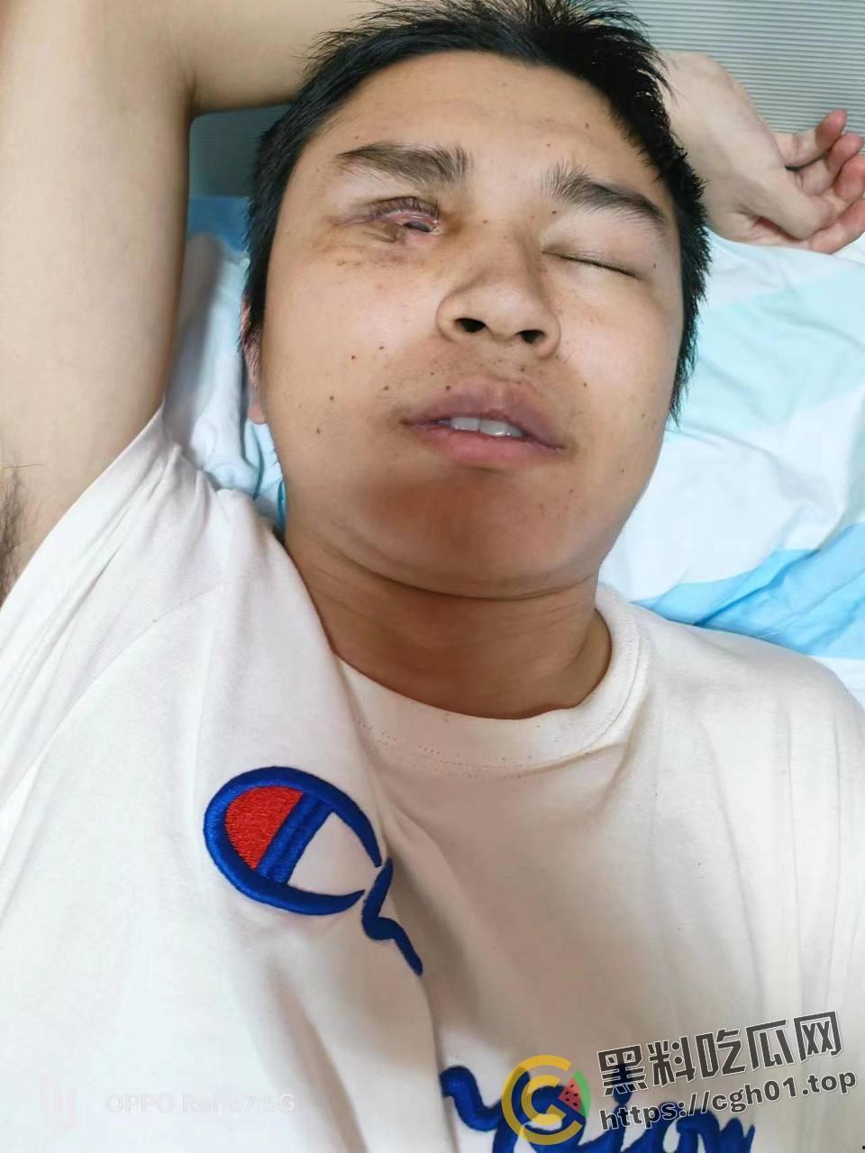 蚌埠大学生为参军做飞秒手术 在部队内遭感染被丢回家 最终不治身亡 家人抖音喊冤被封-8