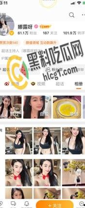 抖音 快手 微博 三栖网红「娜露呀」真正土豪福利流出 微密圈弱爆了！-1