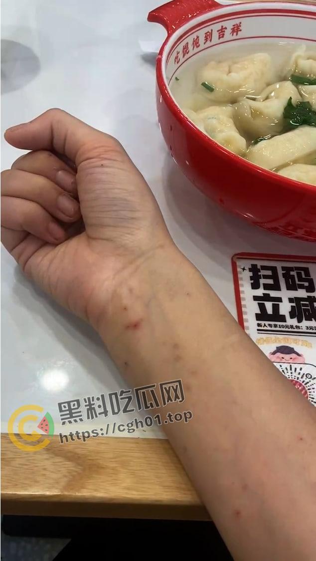 宁波惊现生化母体  圈内全军覆没 医院咨询电话被打爆 夜场公狗母狗的毒圈缩成决赛圈啦-22