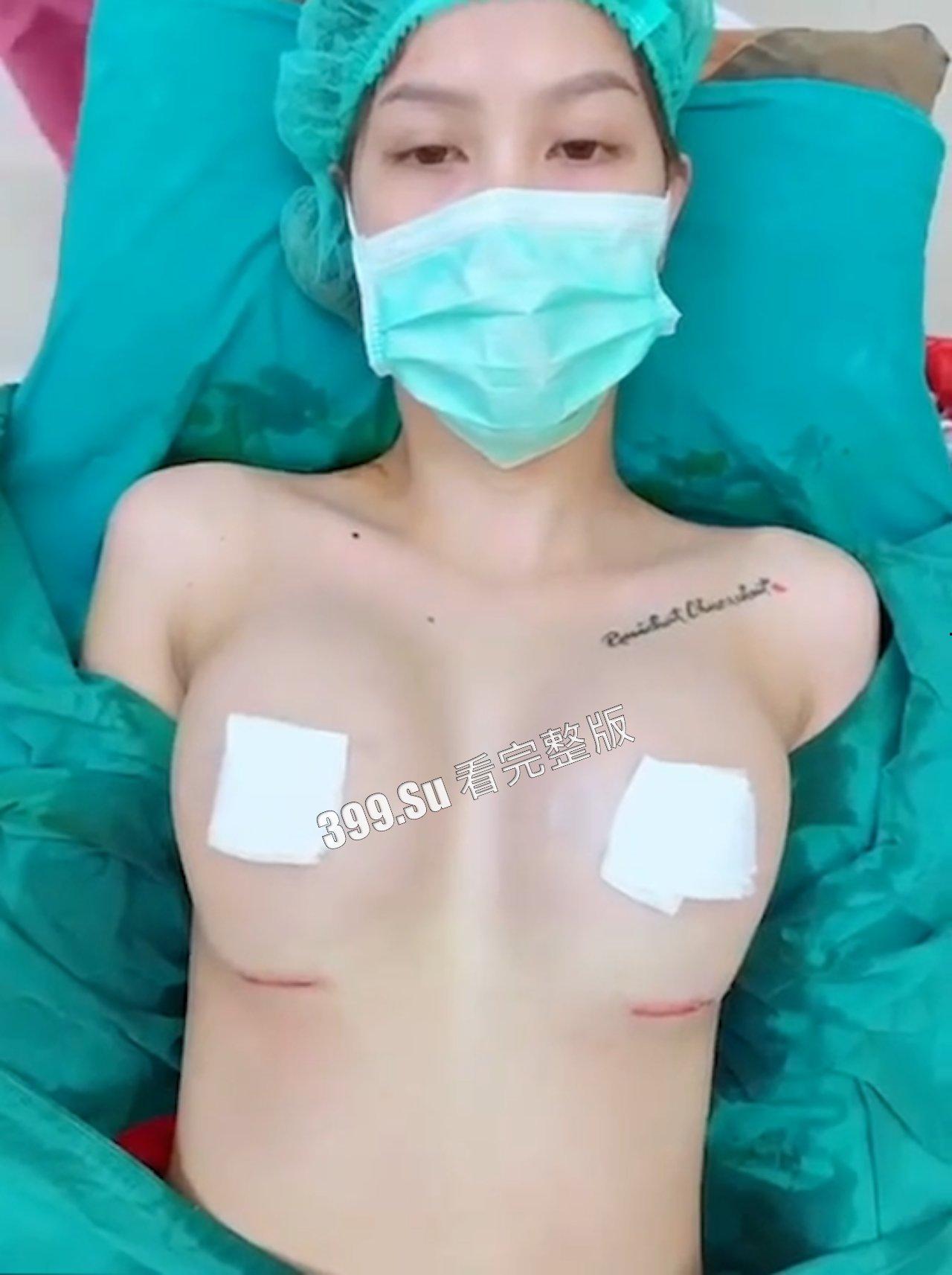 医美整形那些事儿 假的真不了  女人对自己真狠 阴唇黑了就直接切掉 （二）-7