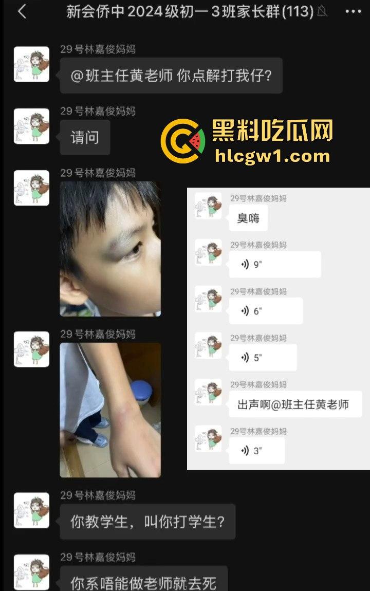 广州金隆小学曝惊天丑闻！初中学生遭体罚虐待，遍体鳞伤，家长被辱骂怒火中烧！-8