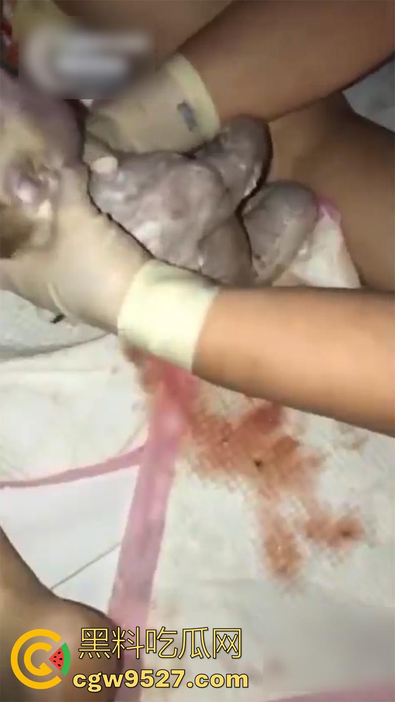 孕妇接生现场画面，体验生孩子的全过程，幸亏是个大肥逼，不然一定痛死了，原来大家都是这么来的啊！-9