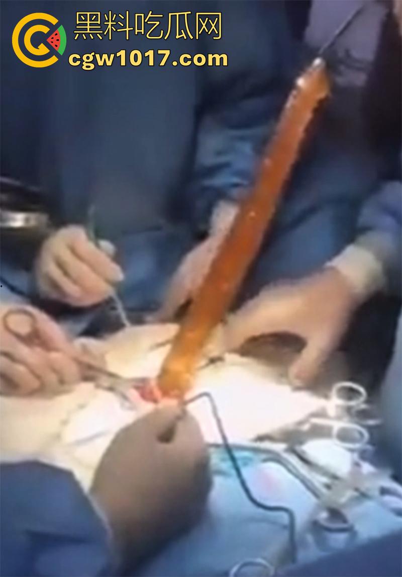 吉林大学三院副院长【刘俊志】，跟杨护士长玩SM，因嗑药嗑多直接玩脱了，护士长竟然被玩挂了！-10