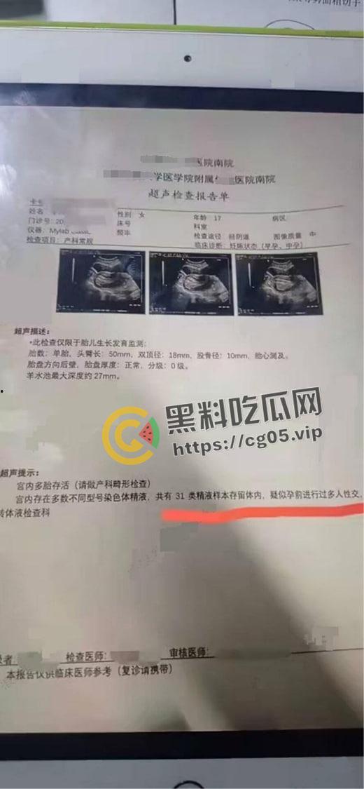 逆天大淫趴！30+男大战7女 其中不乏学生和艾滋病携带者 现场法医都给干吐了-6