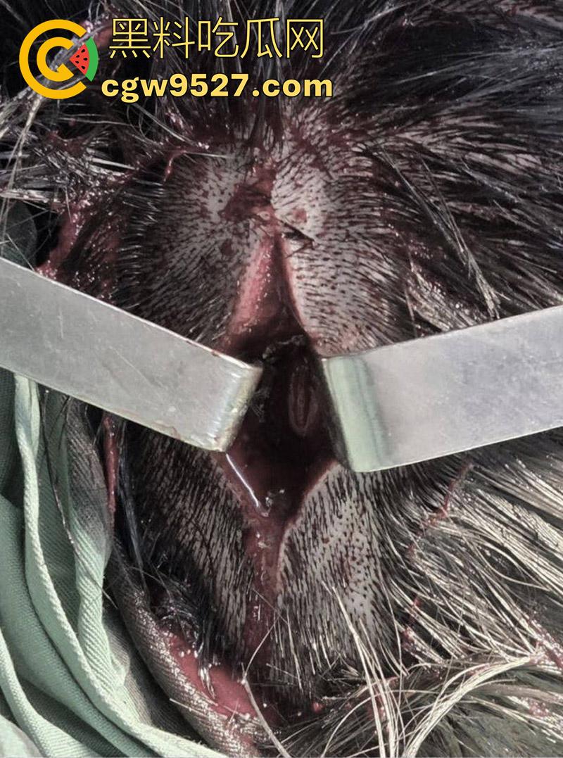 越南海防水果批发市场，发生重大砍人事件，男子手持菜刀疯狂劈砍，导致三人身受重伤，现场视频流出！-5