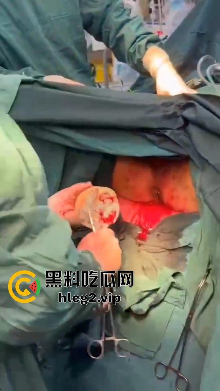 重口慎点！男子硬塞20厘米假体进体内，女子螃蟹夹逼狠整，为了流量太拼了！-8