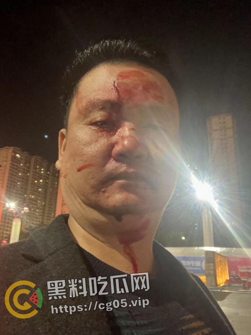 群友约架 不打你不是吴林风！广东普宁池尾两老登【吴林丰】【广武】聊天群内约线下打架  直接真实 打到满脸血 是兄弟就来打我-3