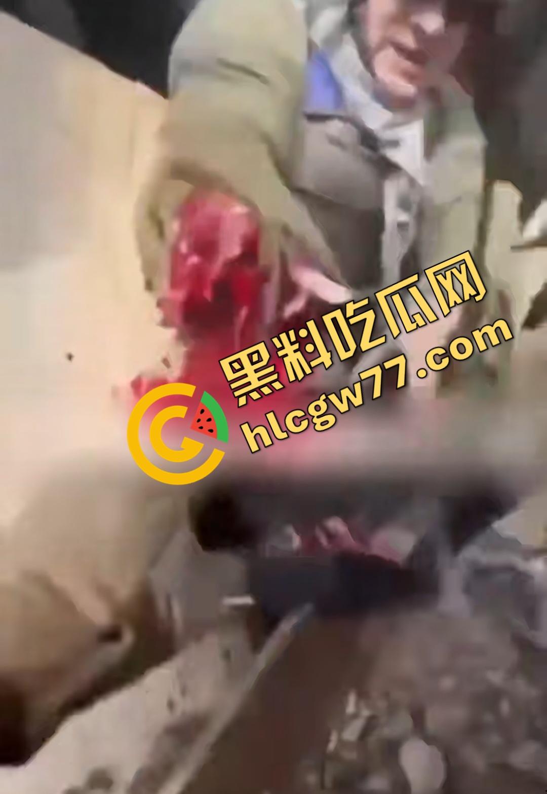 俄乌战场出现食人兵？士兵炸弹炸飞手臂骨髓喷溅，一旁队友饿了还吸食血液充饥！-8