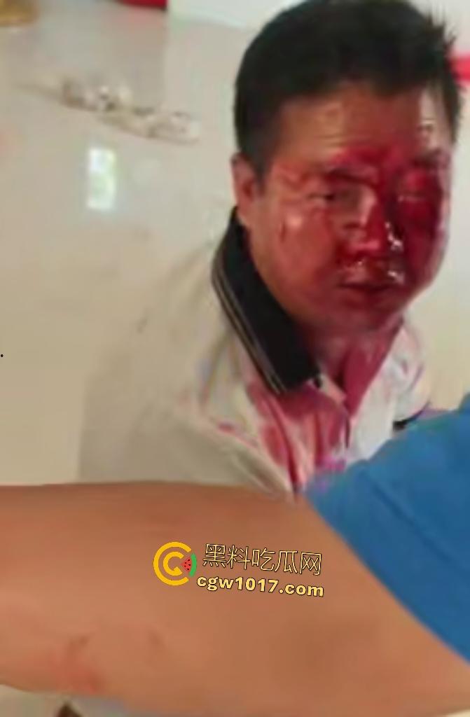 游戏团战关键时刻被老爸关电脑,网瘾儿子阿强直接打亲爸头破血流,老爸跪地求饶“我错了”,老妈哭求和解!-5