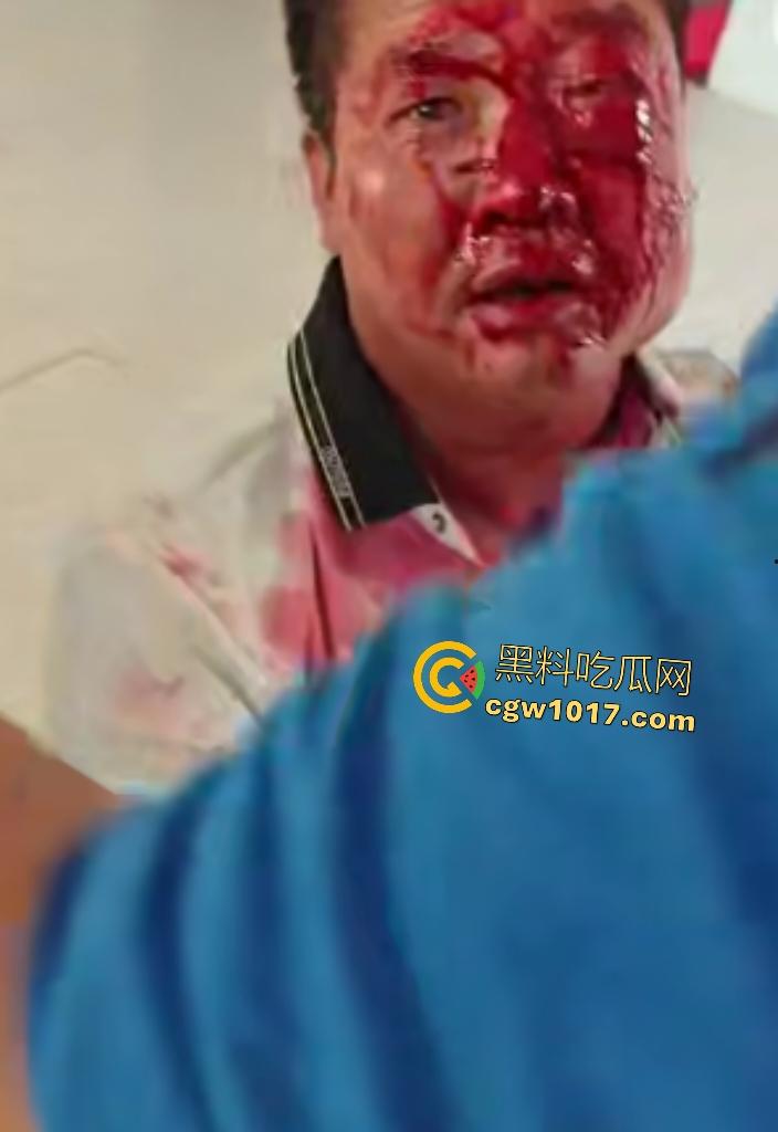 游戏团战关键时刻被老爸关电脑,网瘾儿子阿强直接打亲爸头破血流,老爸跪地求饶“我错了”,老妈哭求和解!-6