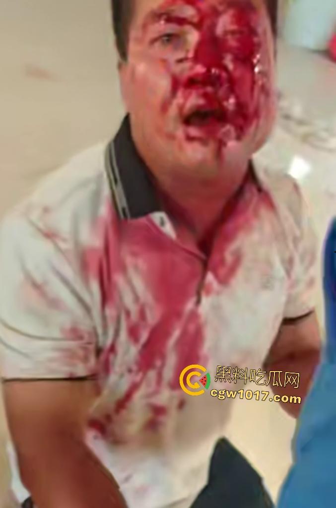 游戏团战关键时刻被老爸关电脑,网瘾儿子阿强直接打亲爸头破血流,老爸跪地求饶“我错了”,老妈哭求和解!-7